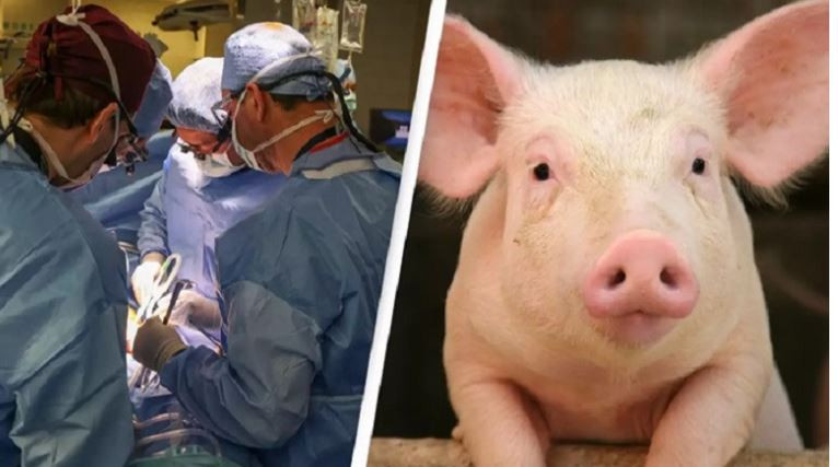 अमेरिकमा जीवित बिरामीमाथी सुँगुरको मृगौला प्रत्यारोपण गरियो